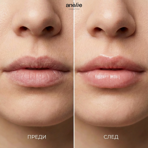 Anèlie Lip Veil — дневен балсам